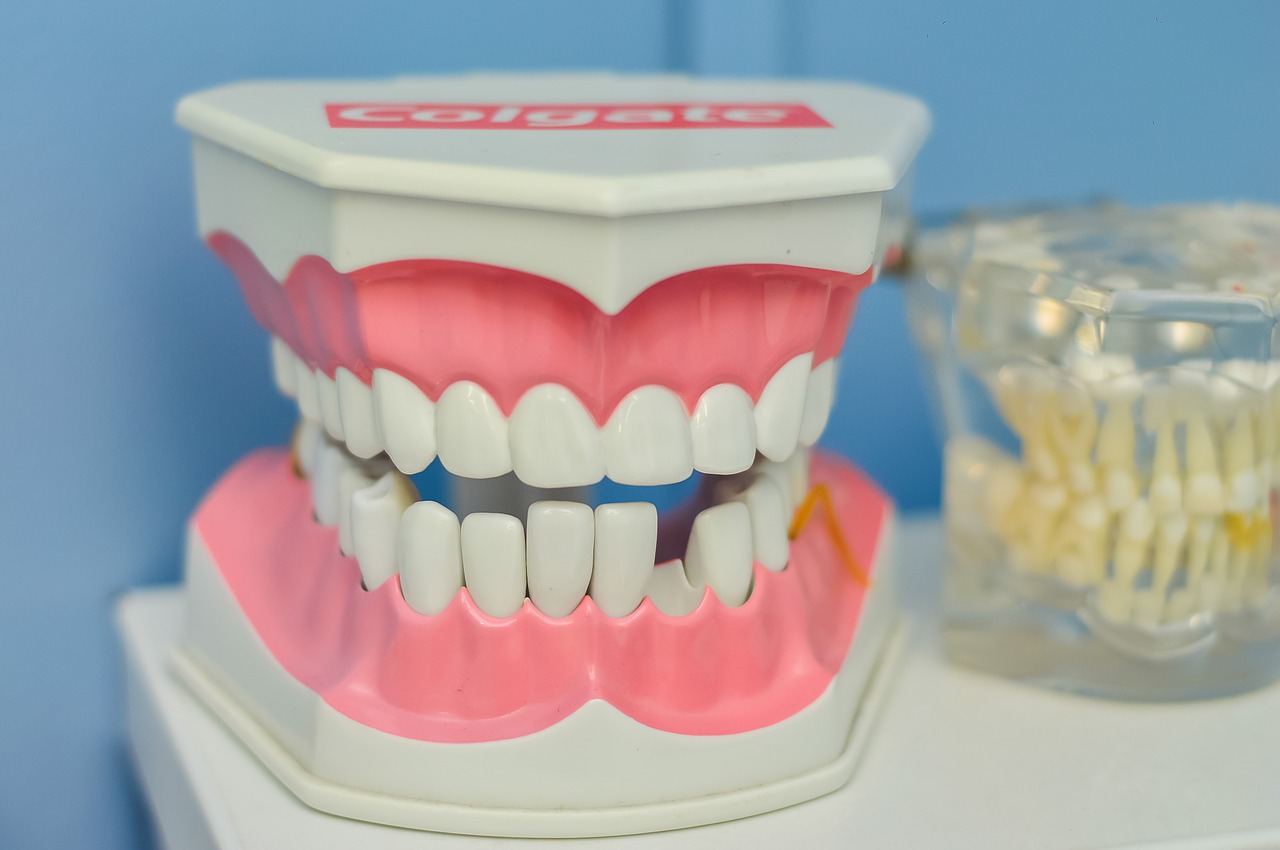 Dental Bridge